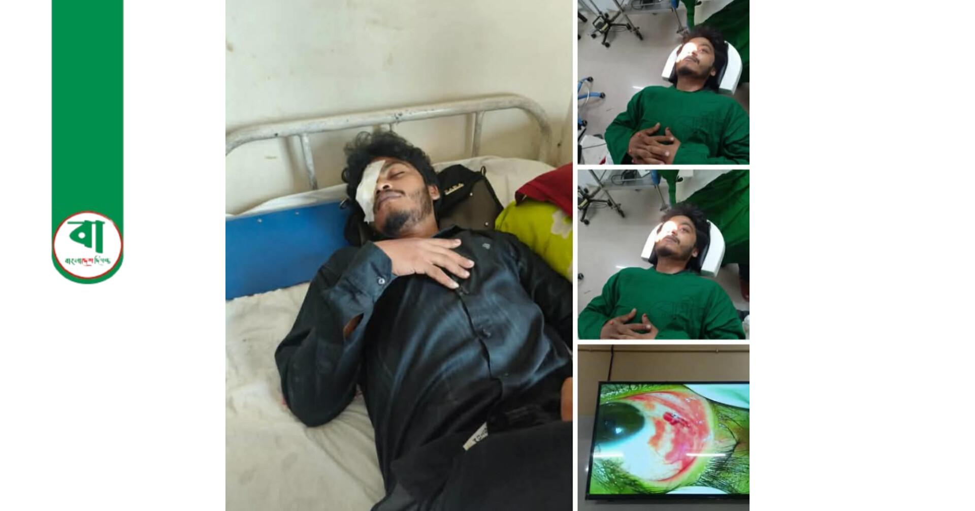 বগুড়া বনানী স্ট্যান্ডে সিএনজি-অটোরিকশা সংঘর্ষে আহত সাংবাদিক আরিফুল ইসলাম, চোখে অস্ত্রোপচারের পরামর্শ