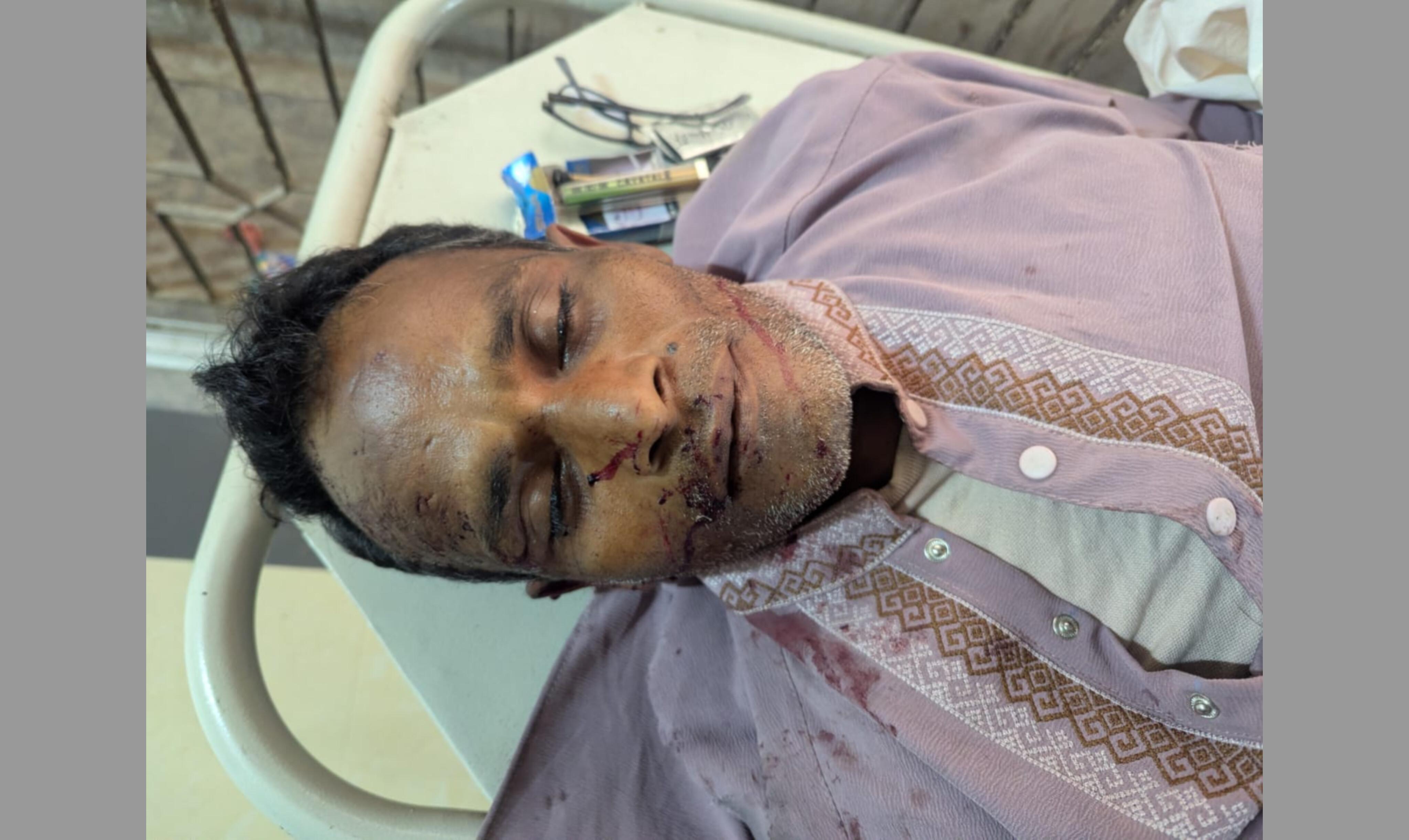 উত্তরায় সড়ক দুর্ঘটনায় অজ্ঞাত ব্যক্তির মৃত্যু